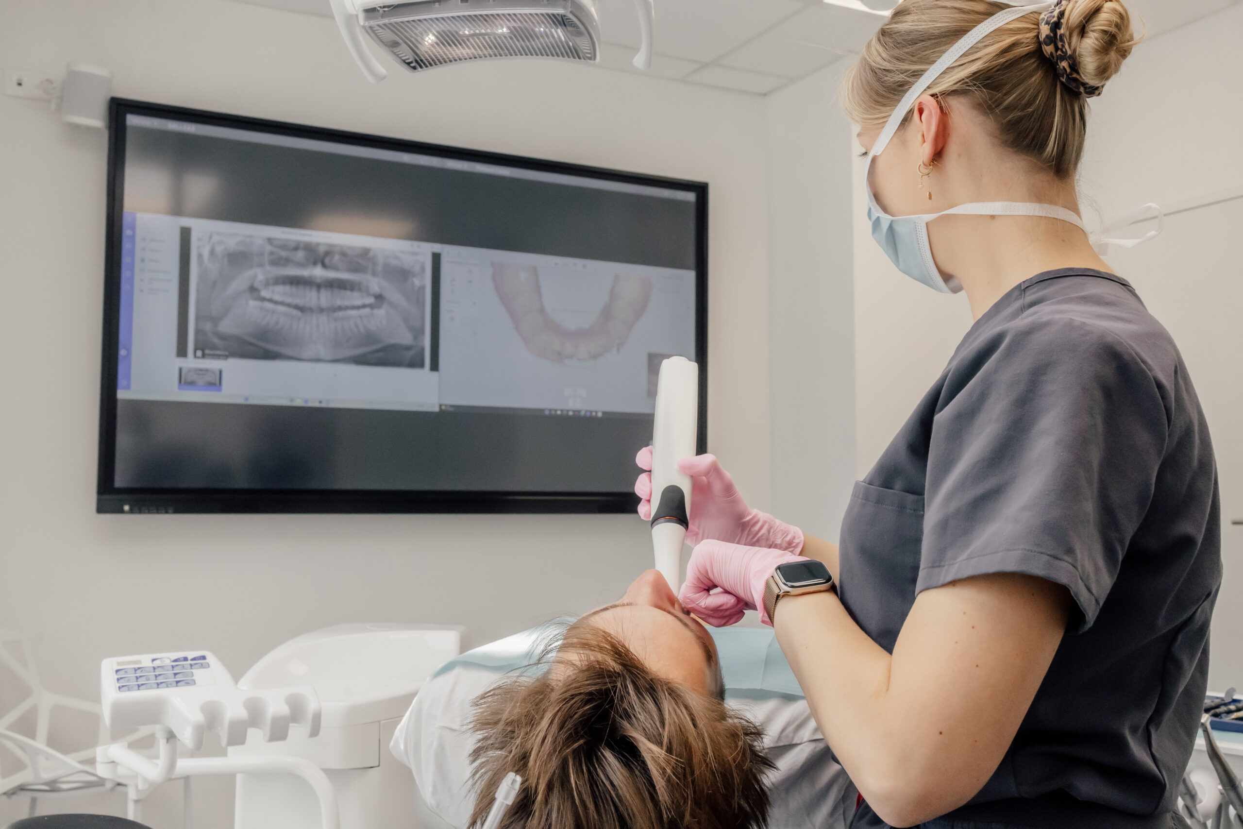 Scannage dentaire empreinte mâchoire caméra 3D visu sur écran