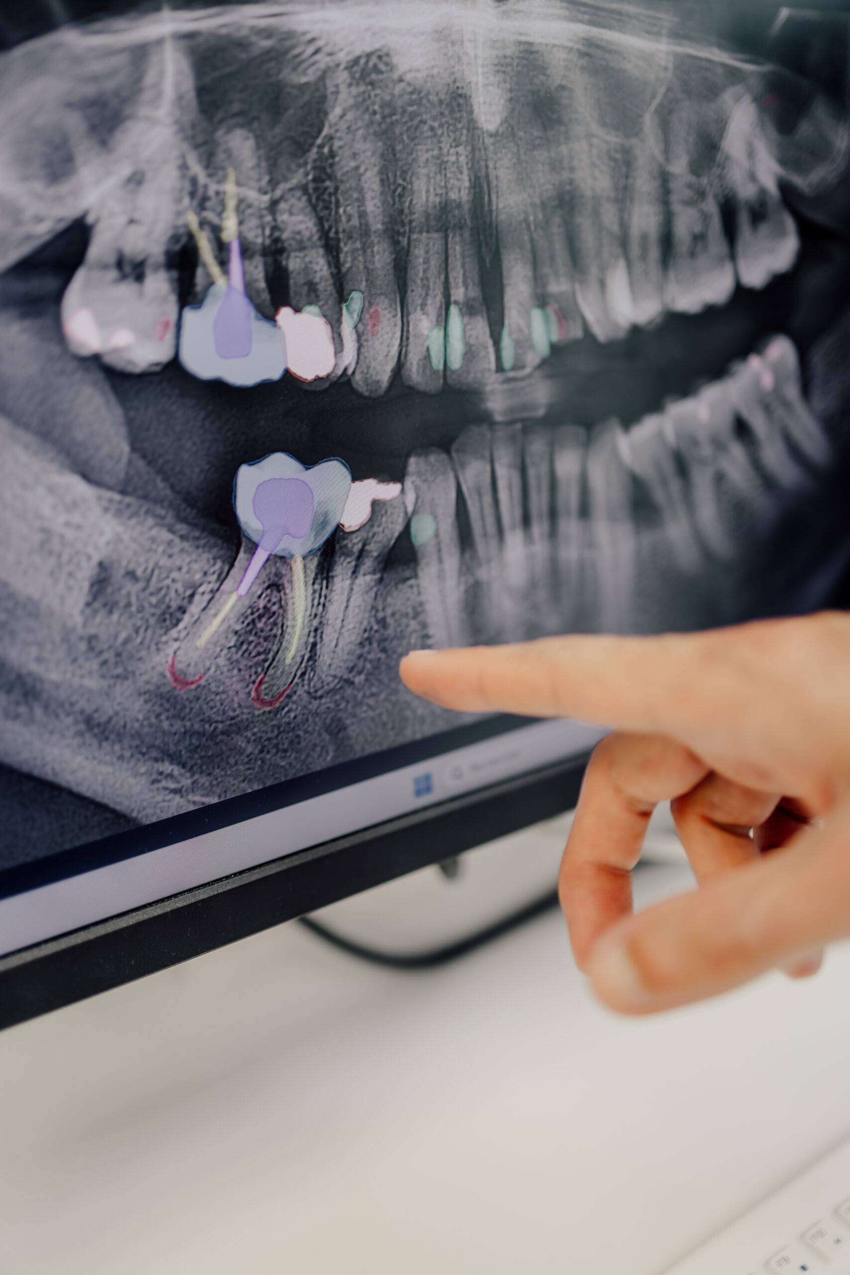 IA DIAGNOSTIC ZOOM